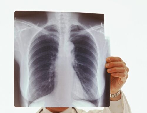 Women non-smokers still around 50% more likely than men to develop COPD