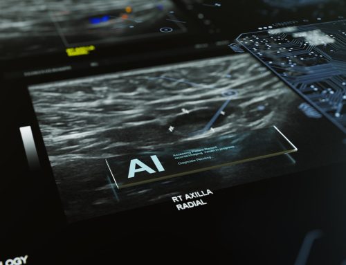 AI model detects very early normally ‘invisible’ tissue changes of pancreatic cancer