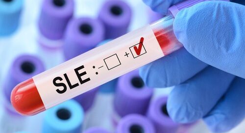 SLE blood test vial