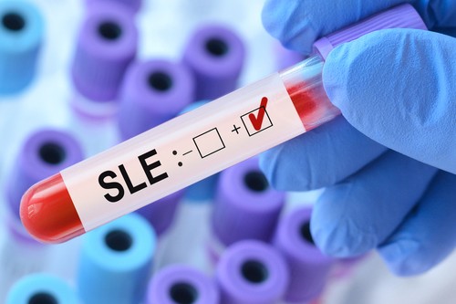 SLE blood test vial